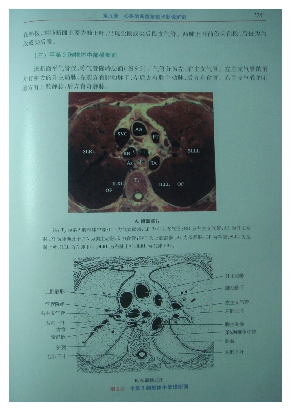 心脏的断层解剖和影像解剖_第3页