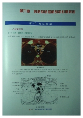 心脏的断层解剖和影像解剖