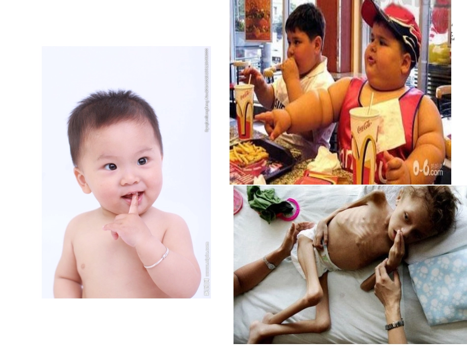 儿童营养评估及干预措施概述_第2页