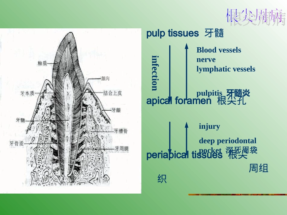 第十一章 根尖病_第2页