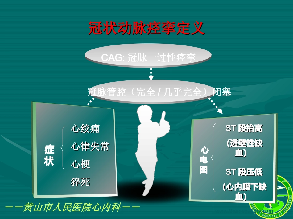 血管痉挛性心绞痛(变异型心绞痛)分析_第2页