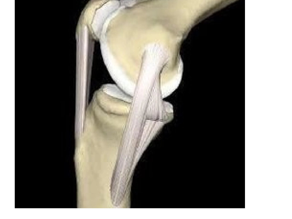 膝关节炎的锻炼_第2页