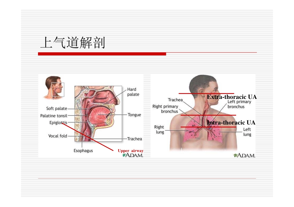 上气道梗阻-高恒淼_第2页