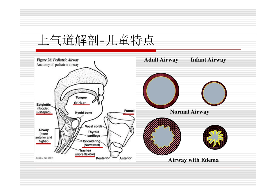 上气道梗阻-高恒淼_第3页