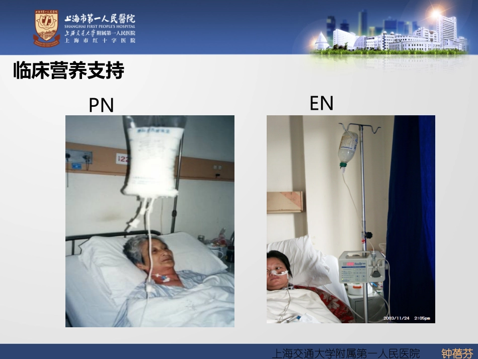 胸外科营养与代谢支持的途径的比较和选择-(2)_第2页