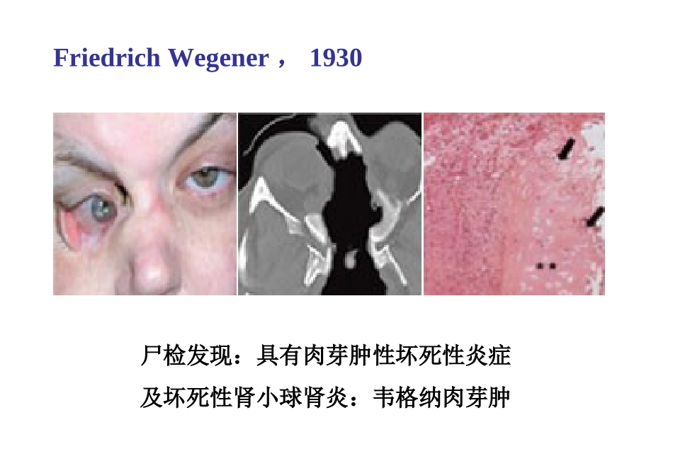 系统性血管炎2013_第2页