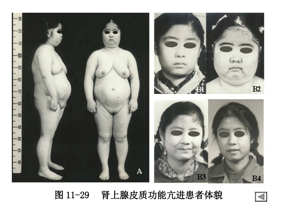 内分泌系统I_第2页