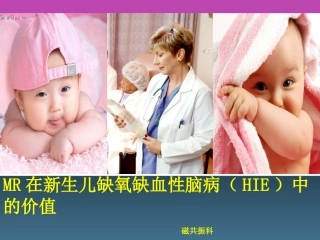 MR在新生儿缺氧缺血性脑病的价值