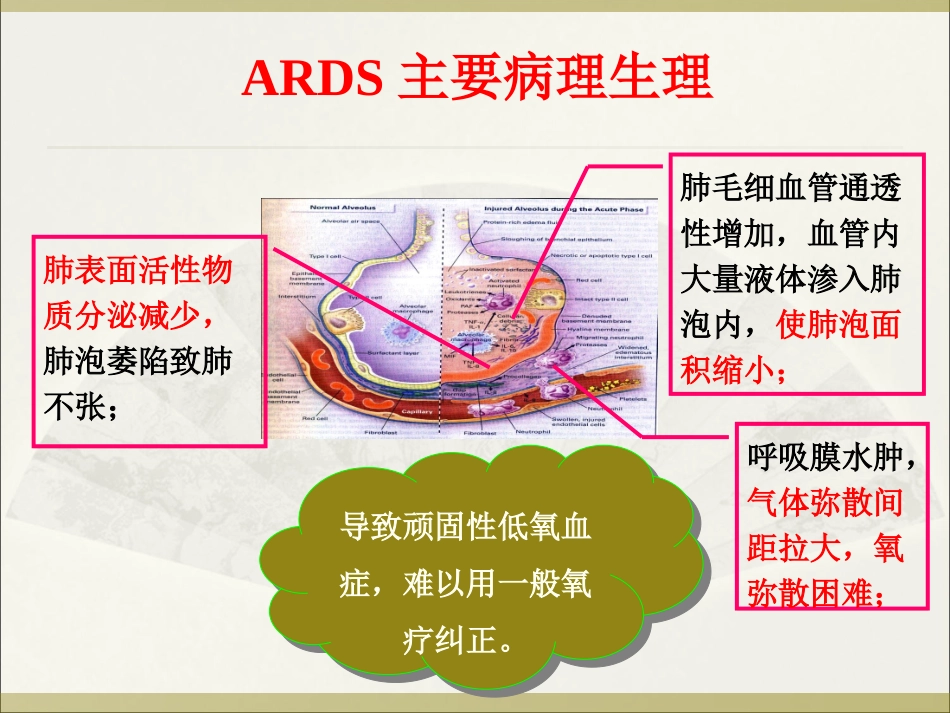 急性呼吸窘迫综合征诊治现状及思考(2012.122济南)剖析_第3页