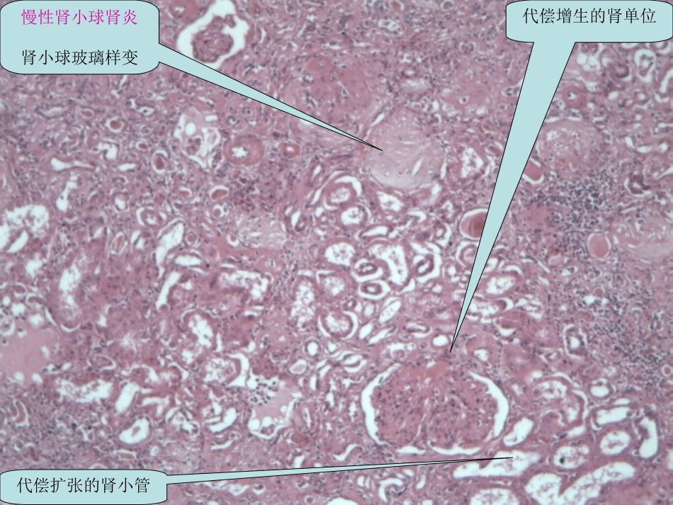 泌尿系统疾病(修正版)_第2页