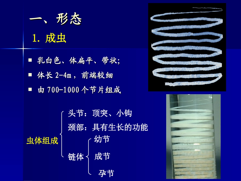 寄生虫-猪带绦虫_第2页