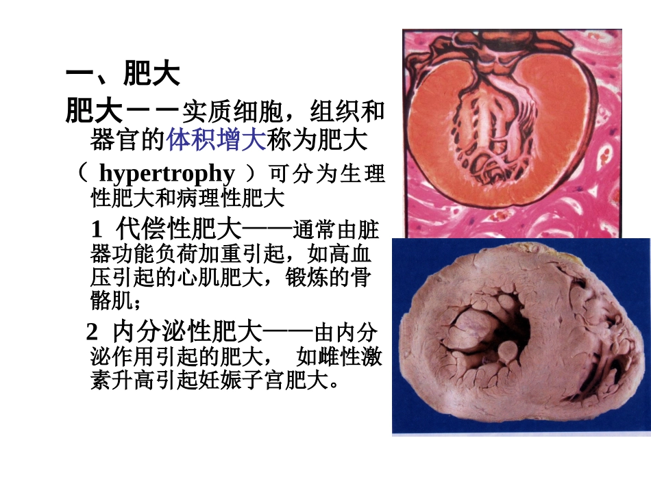 二、三讲-适应、损伤、修复_第3页