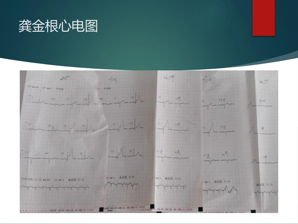 胸痛中心质量分析6_第3页