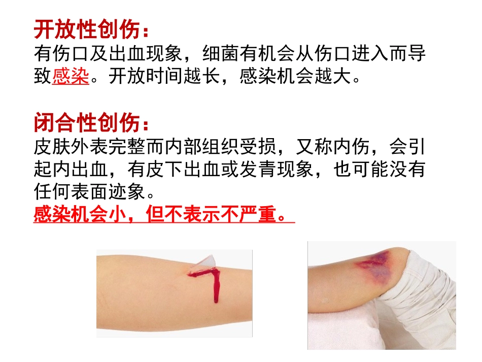 创伤的识别及处理_第3页