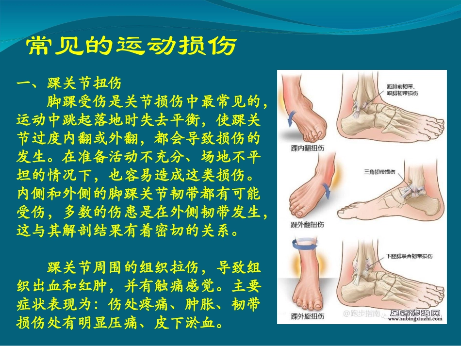 hw----常见损伤的应急处理与急救ppt_第2页