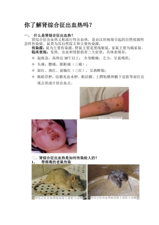 肾综合征出血热宣传材料