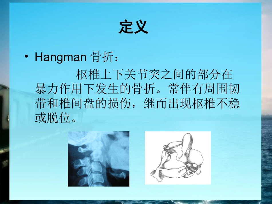 Hangman骨折_第2页