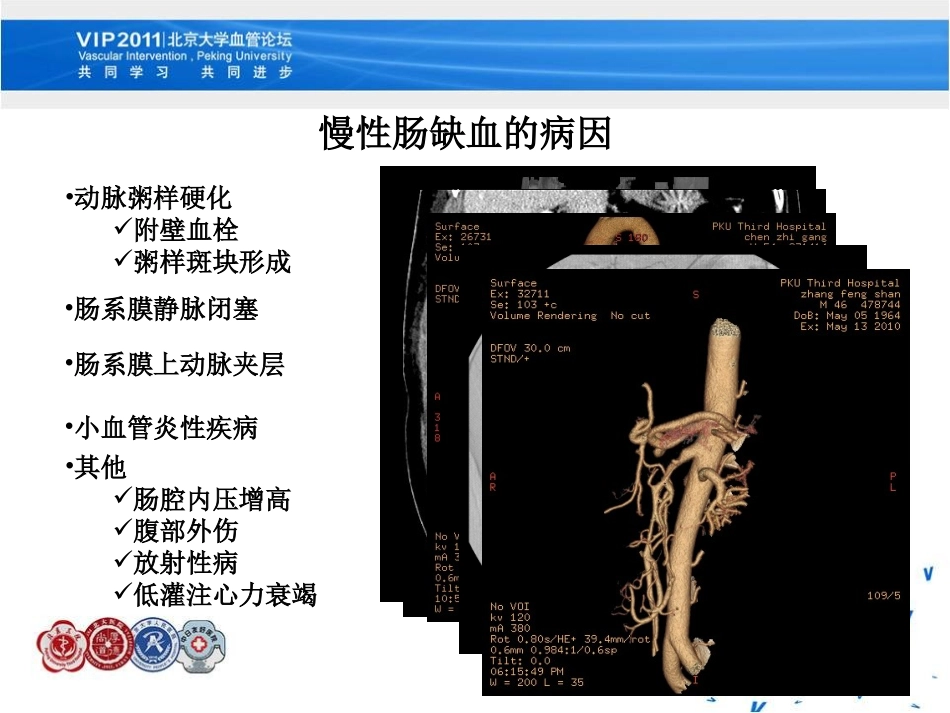 混合手术治疗慢性缺血性肠病 李天润 0815_第2页