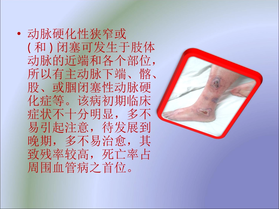 动脉硬化闭塞症_第3页