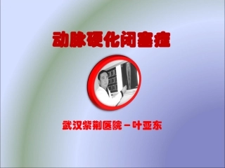 动脉硬化闭塞症