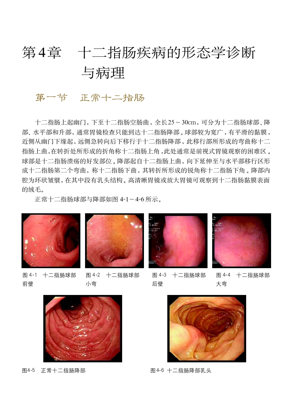 十二指肠疾病的形态学诊断与病理_第1页