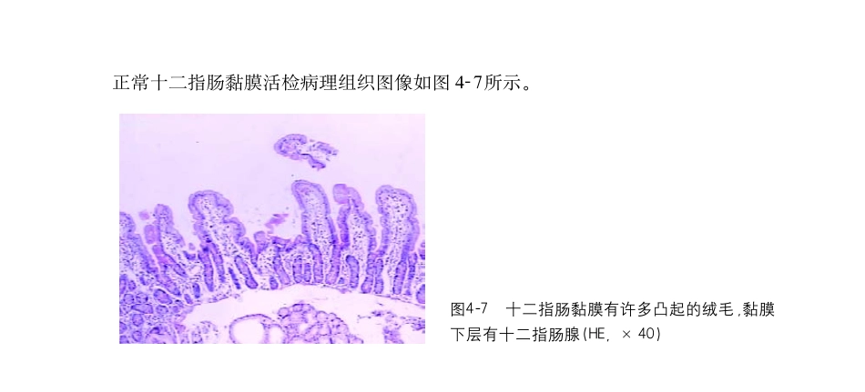 十二指肠疾病的形态学诊断与病理_第2页