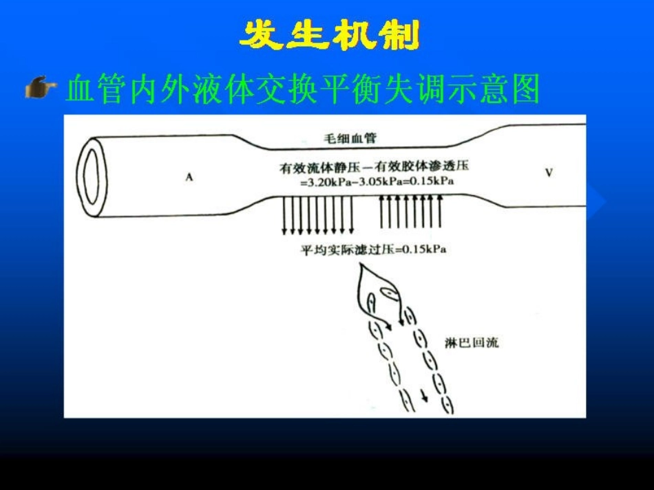 水肿-修改版_第2页
