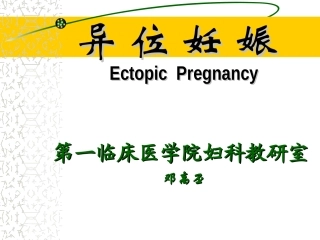异位妊娠ppt