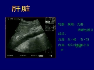 B超影像图谱