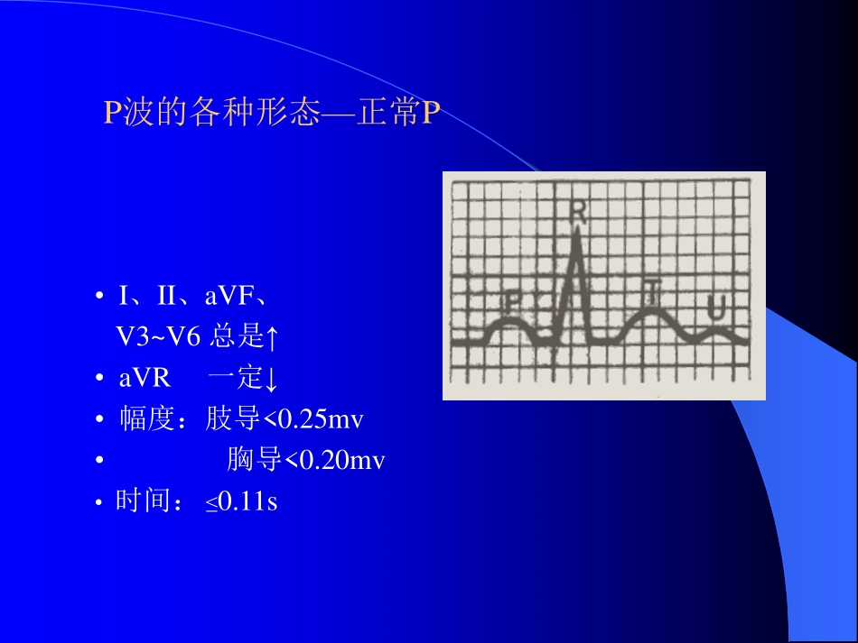 心电图阅读[160P][10.0MB]_第3页