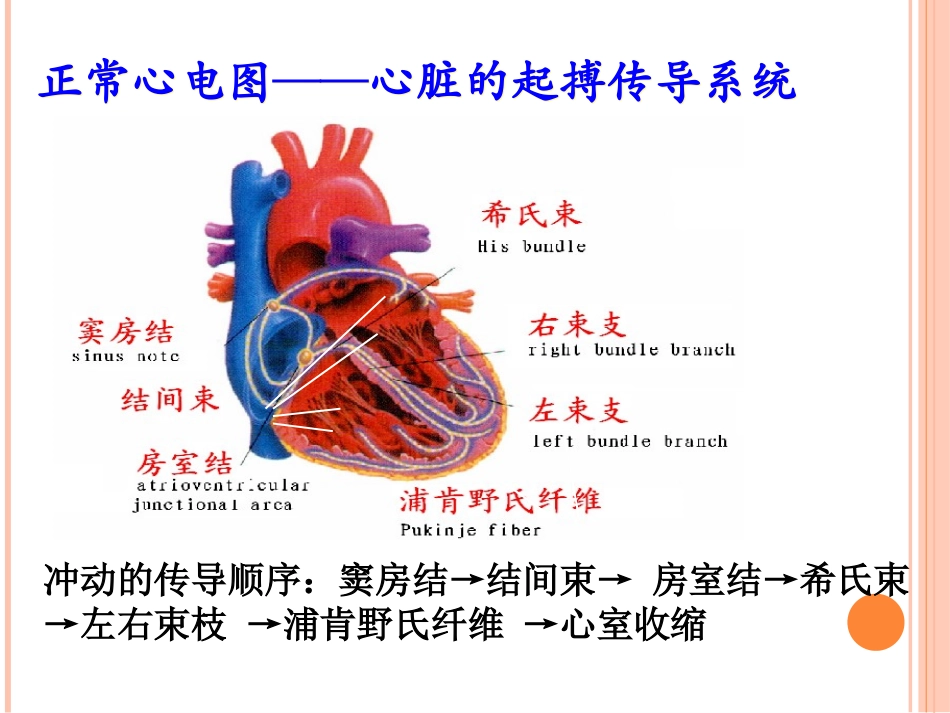临床常见心律失常的识别及治疗_第2页