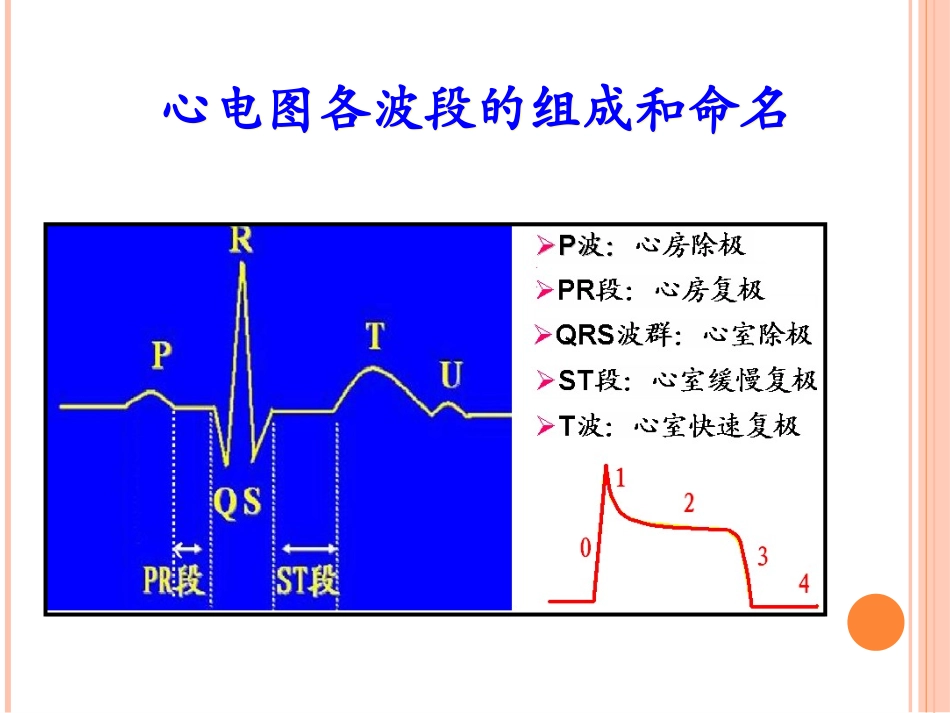 临床常见心律失常的识别及治疗_第3页