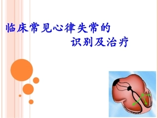 临床常见心律失常的识别及治疗