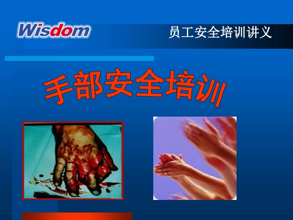 杜绝手部伤害_第2页