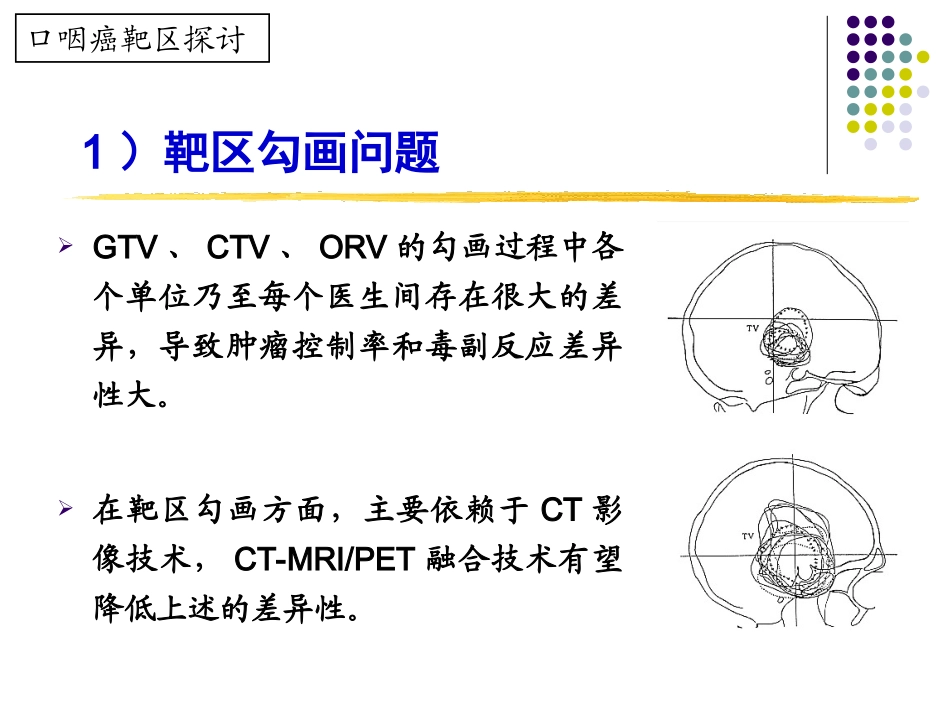 口腔癌精确放疗_第3页