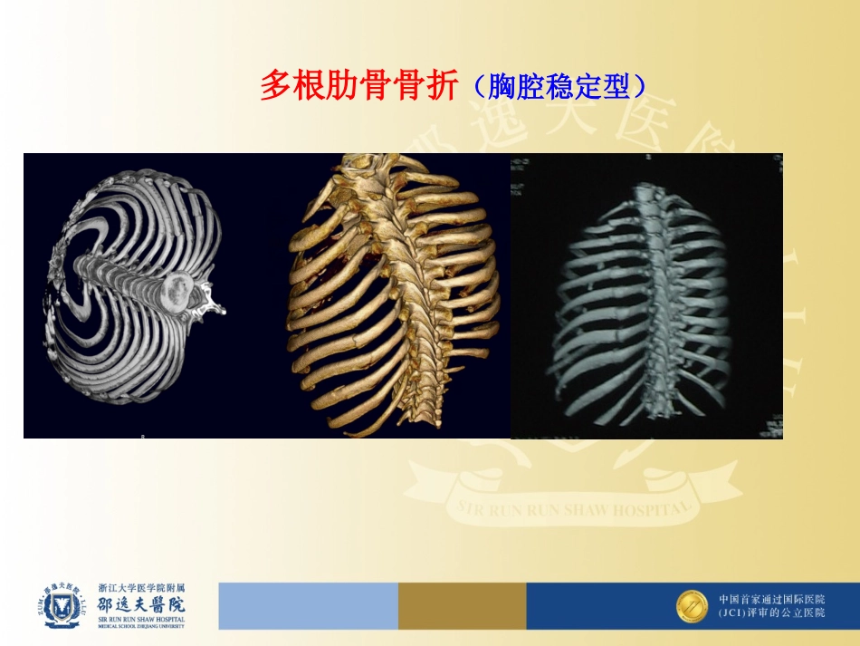 多根肋骨骨折胸腔不稳定型_第3页