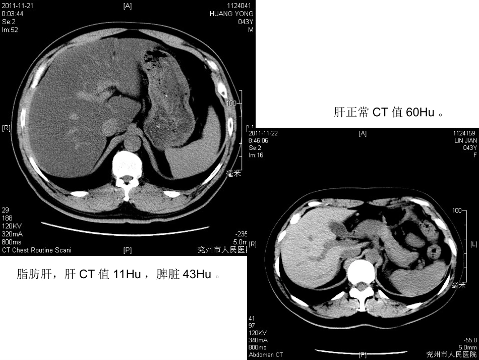 腹盆部影像图片_第3页