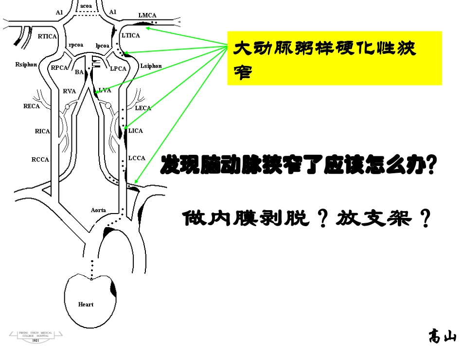 发现脑动脉狭窄了应该怎么办？-20120813_第2页