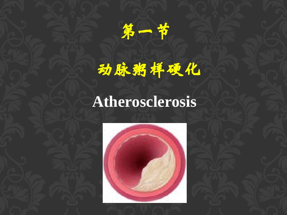 动脉粥样硬化和高血压(1)_第2页