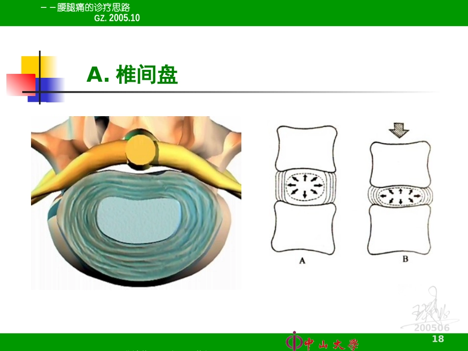 腰腿痛的诊疗思路_第3页