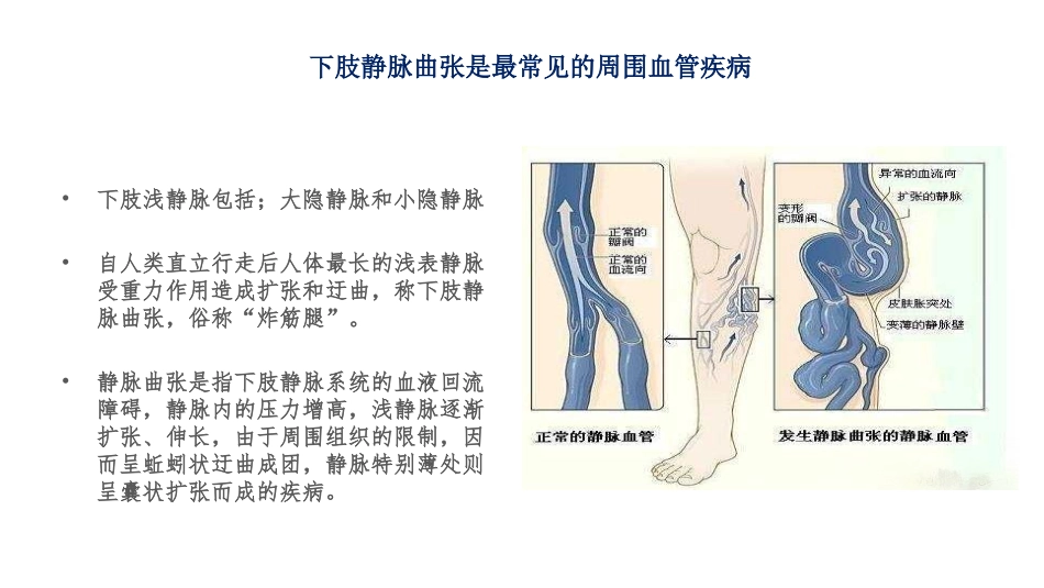 医用弹力袜应用2018.04_第3页