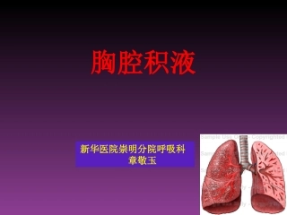 胸腔积液-zjy