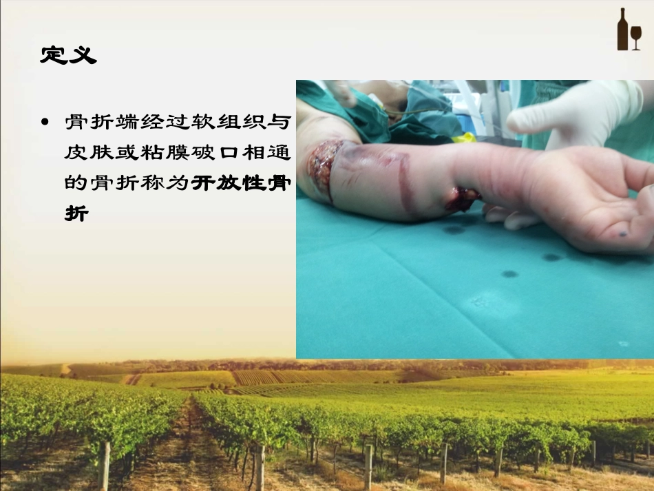 开放性骨折的处理_第2页