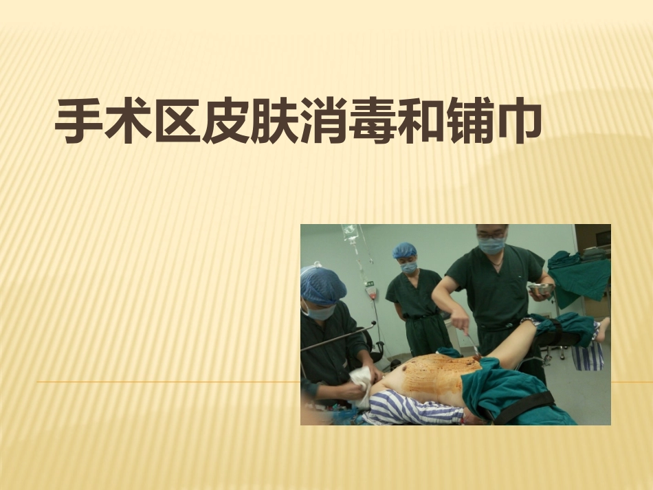 手术区皮肤的消毒和铺巾_第1页