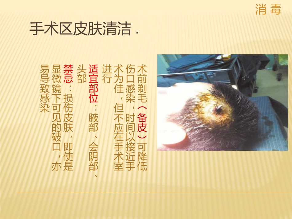 手术区皮肤的消毒和铺巾_第3页