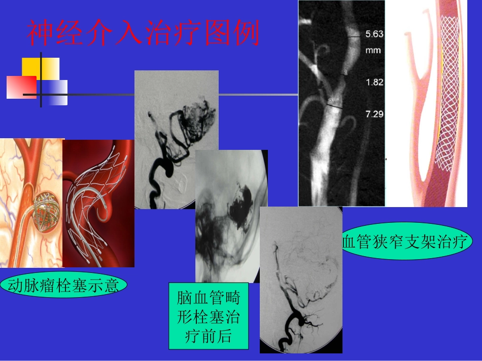 神经外科宣传栏2_第2页