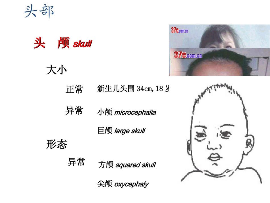 头颈部体格检查_第3页