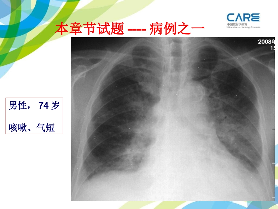 Care-间质病变试题_第2页