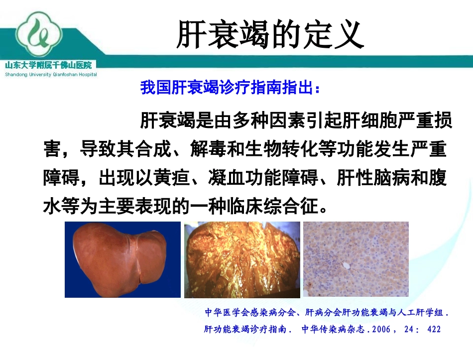 人工肝支持系统ALSS_第2页