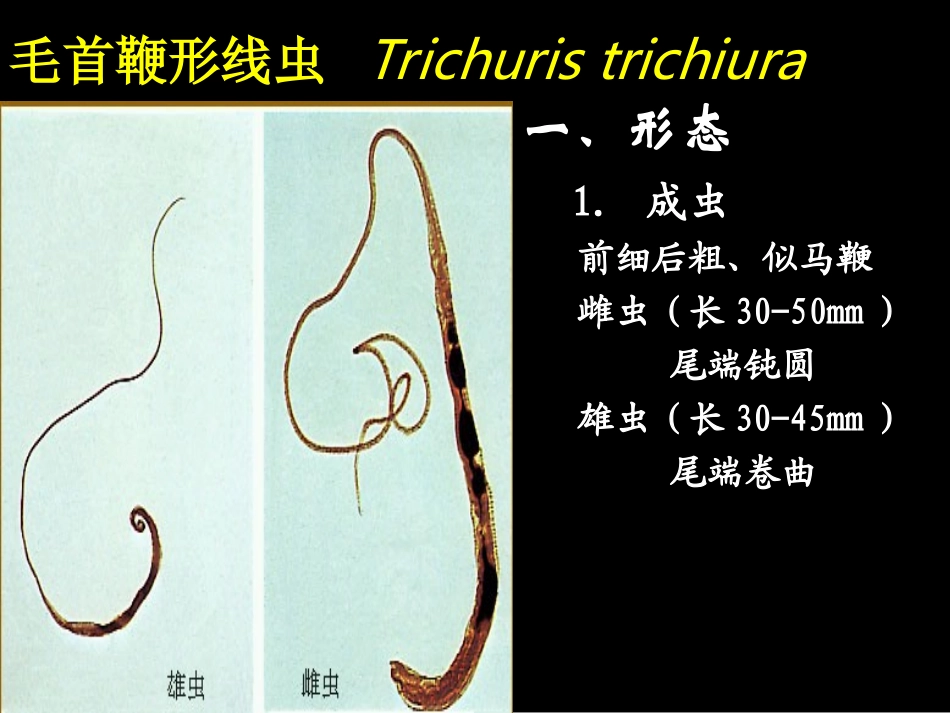 毛首鞭形线虫(鞭虫_第2页